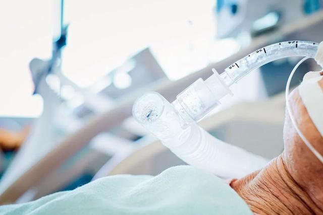 不拔管，百万赔偿就没了